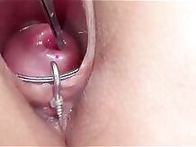 Extreme cervix playing with insertion metal chain in uterus