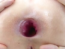 TRUE ANAL Burbuja butt Mia Malkova analmente brecha